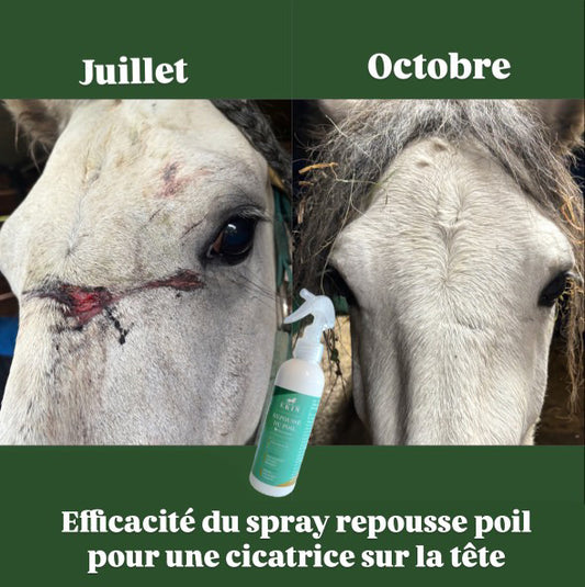 Repousse du poil EKIN