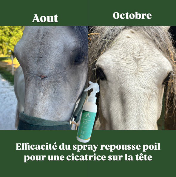 Repousse du poil EKIN